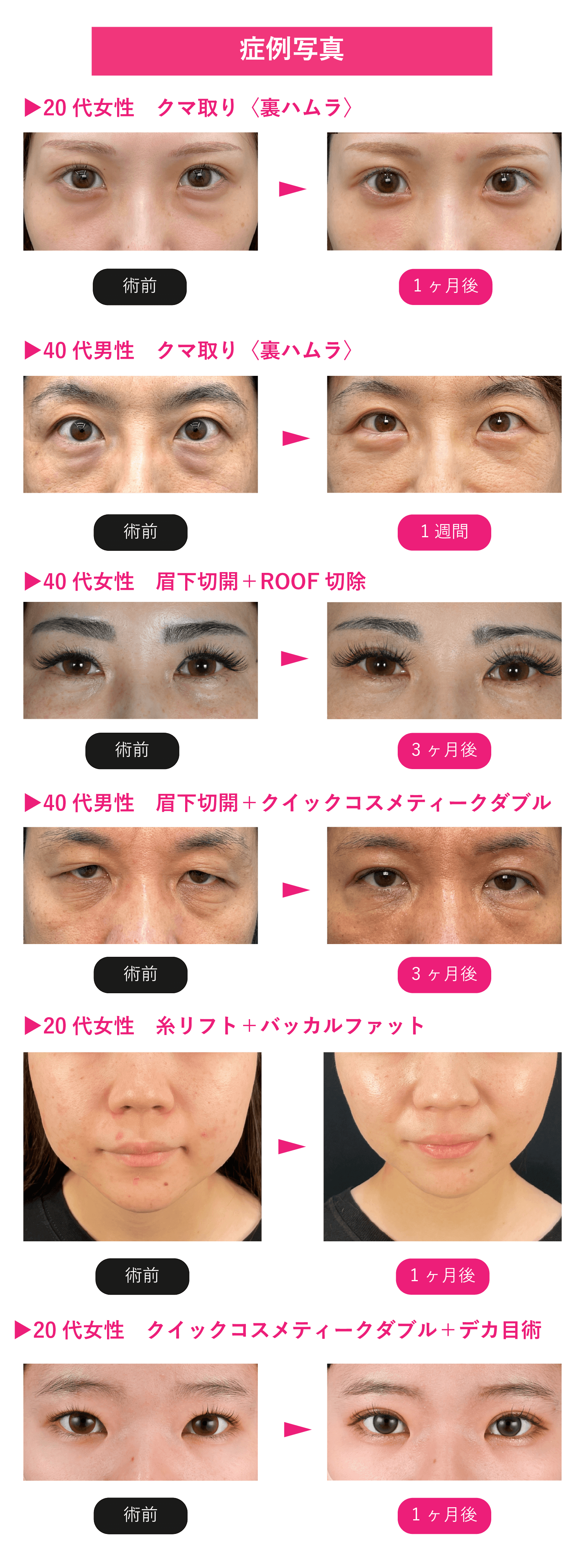 インスタグラムで人気の症例まとめました♪