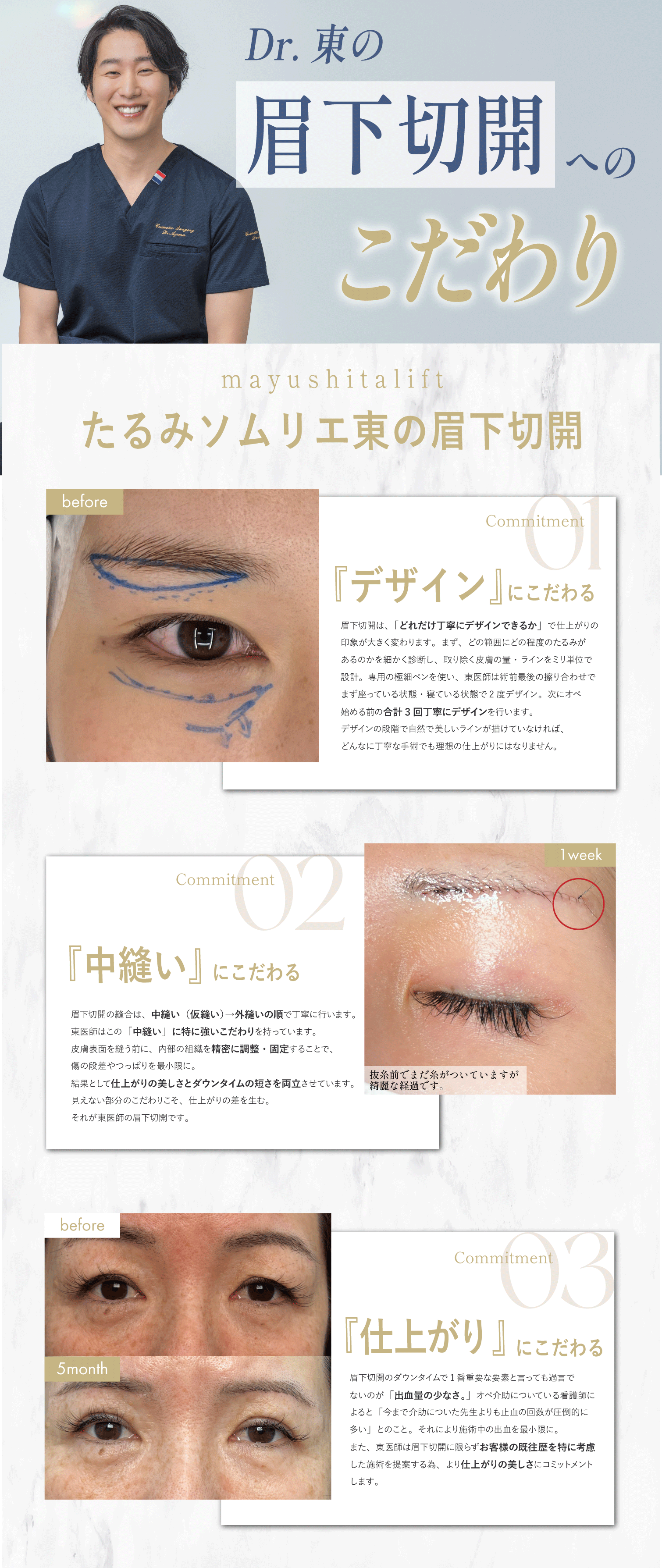 切開には特に強いこだわりあり。