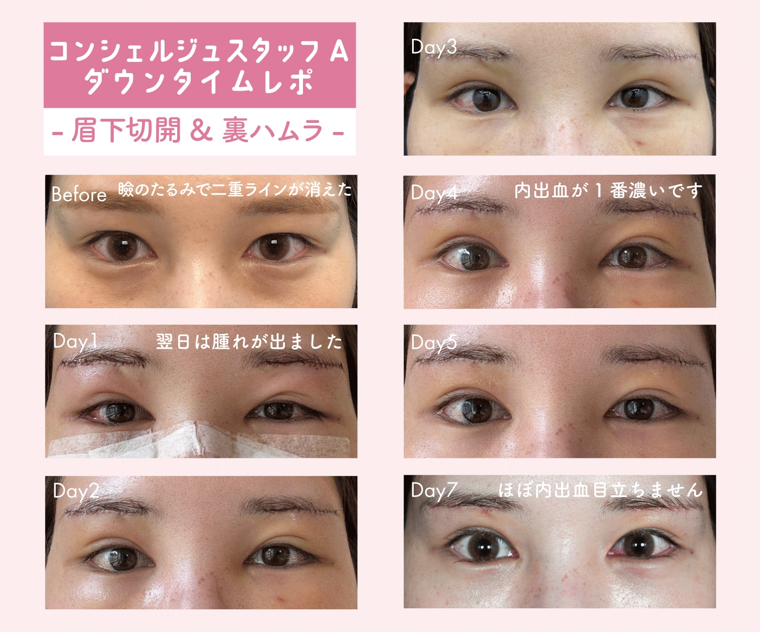 当院コンシェルジュ:Aさんの場合