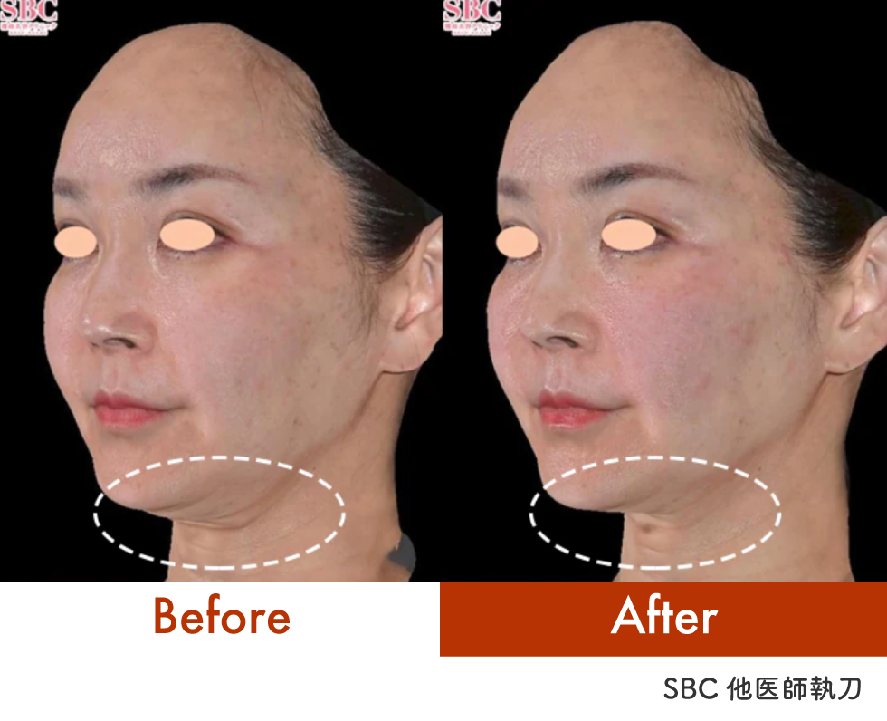 首下のたるみに注目して下さい⚠️