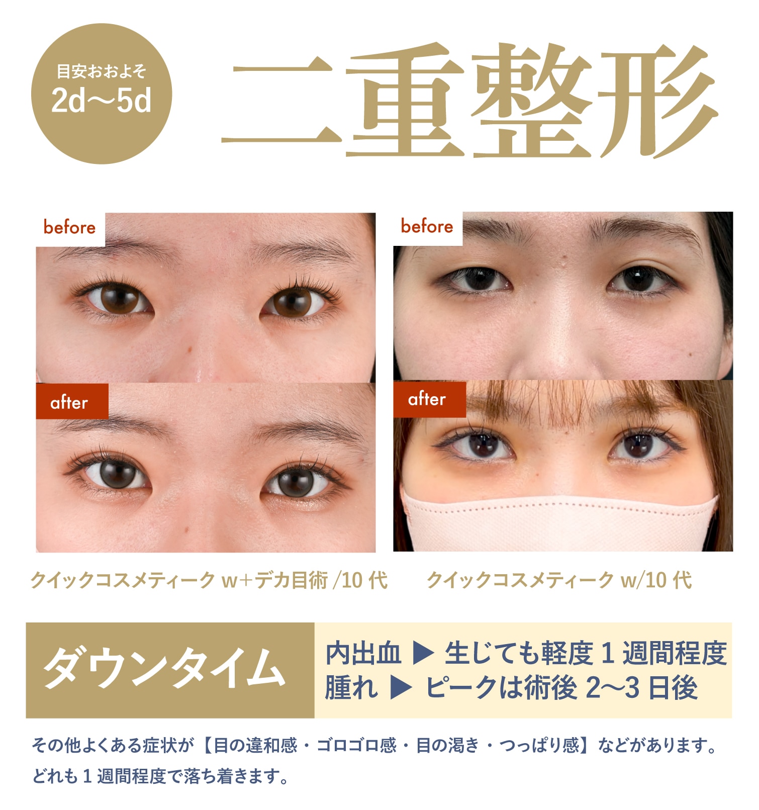 【DTほぼナシ×年末駆け込み】二重整形