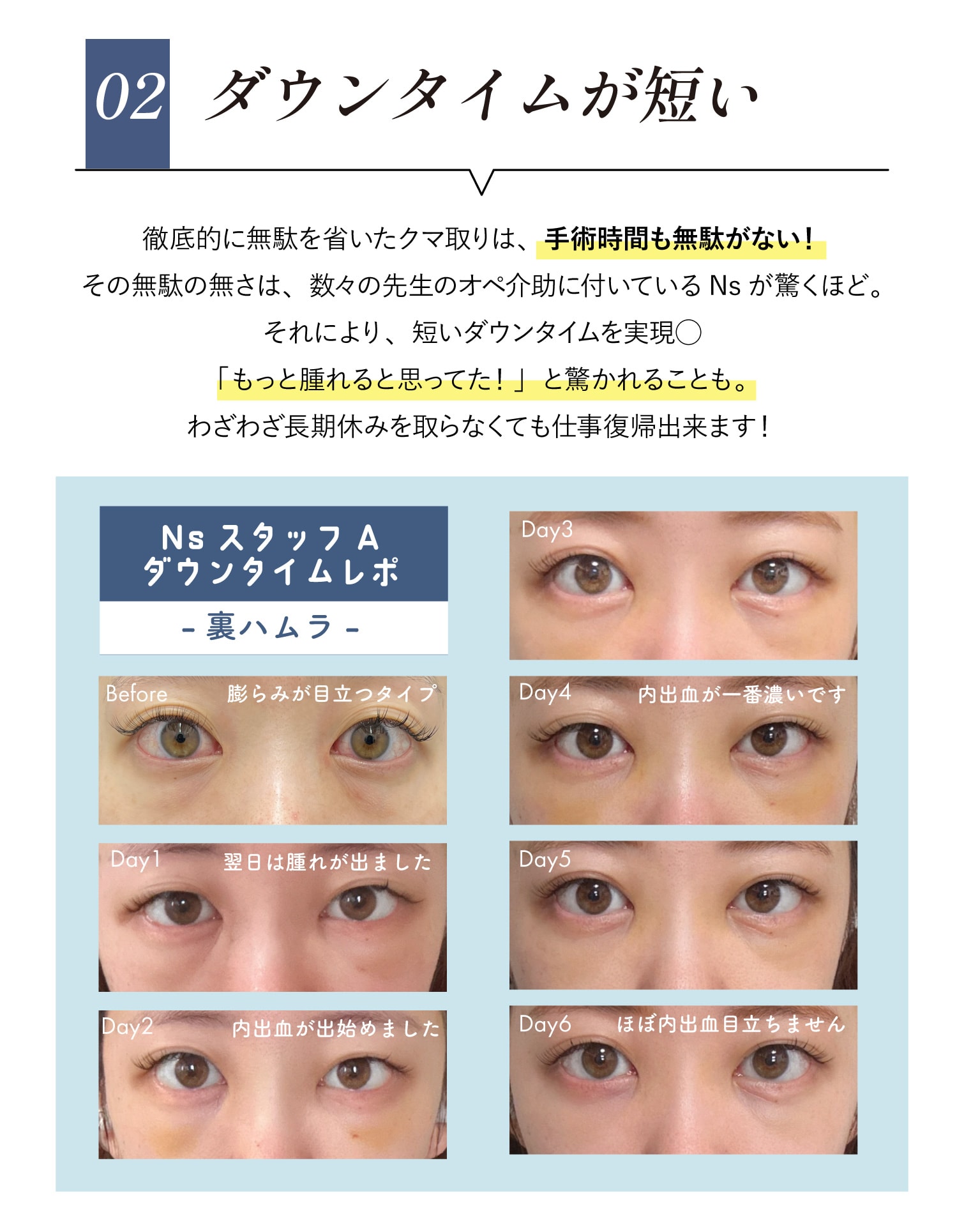 選ばれる理由②ミニマムダウンタイムクマ取り