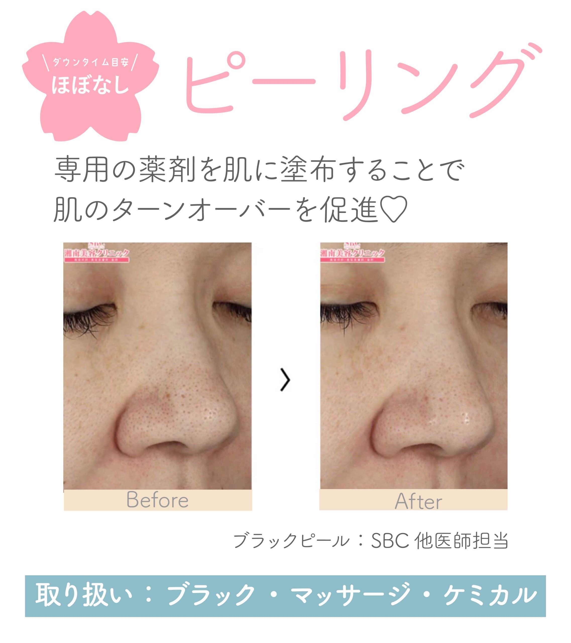 くすみを一掃したいならコレ！