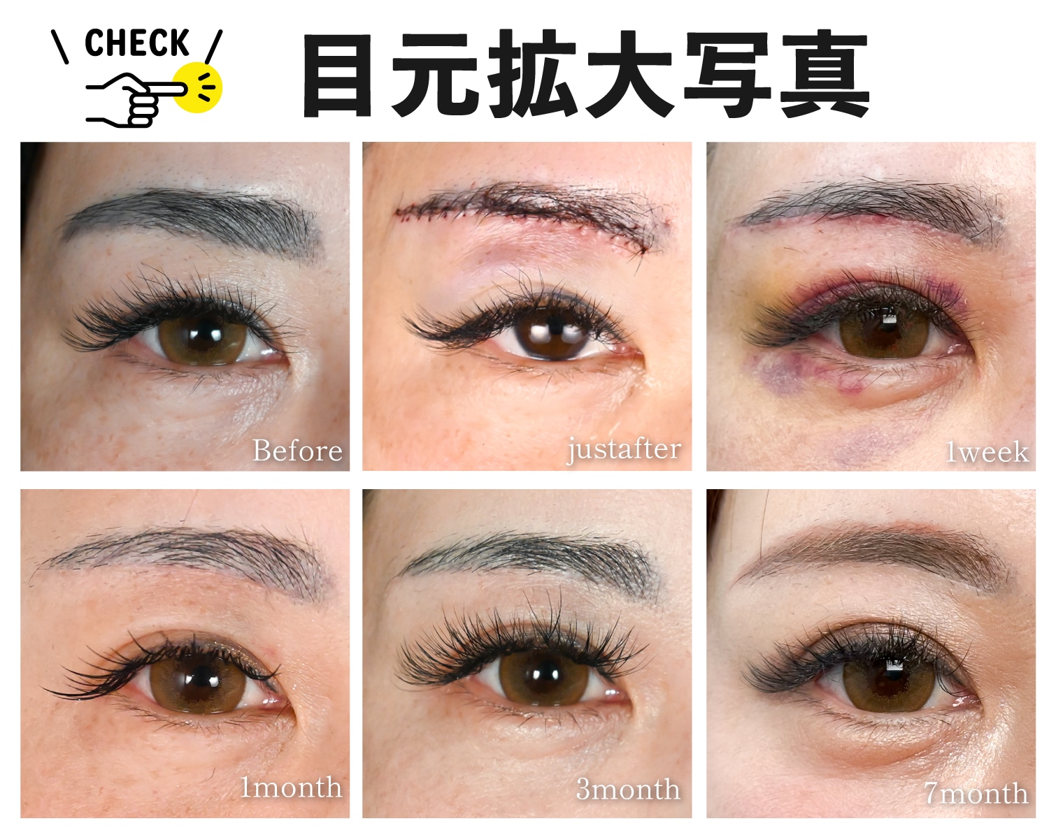 傷跡は目立ちませんか？