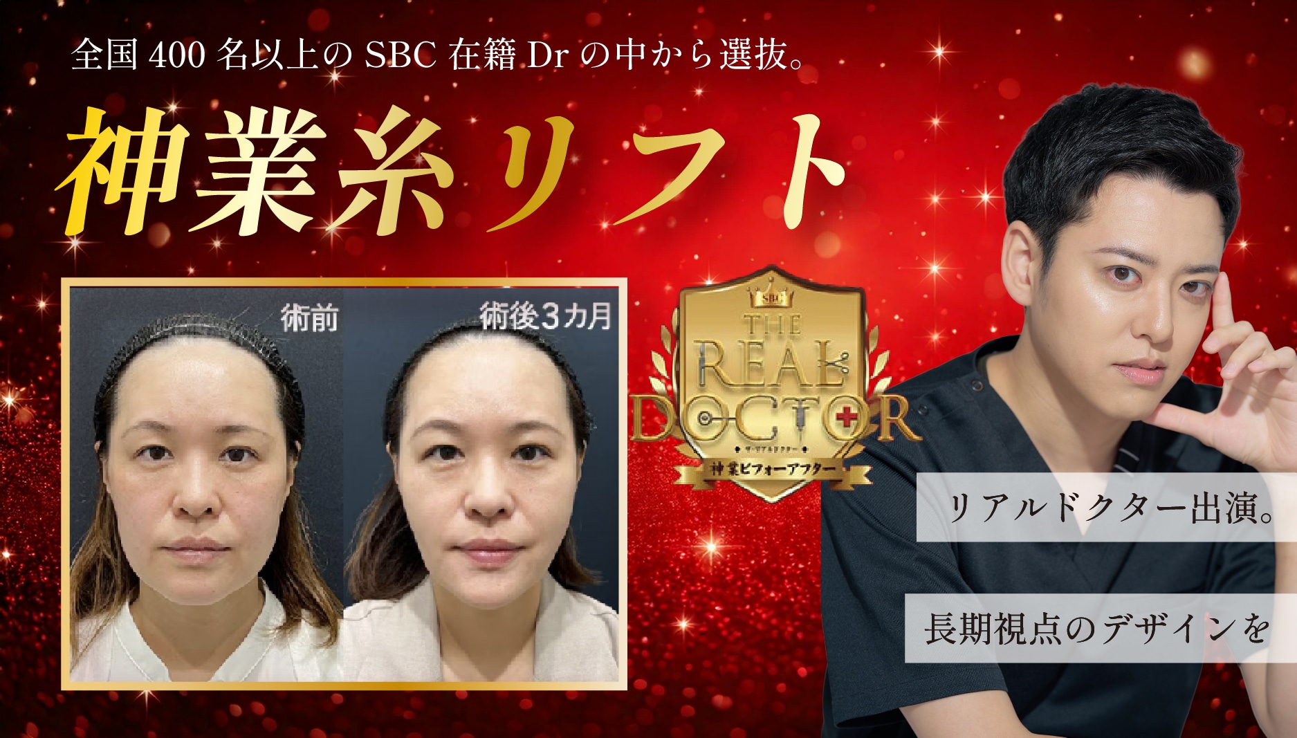 三重で糸リフトするなら【リアルドクター出演！】全国400名以上のSBC在籍Drの中から選ばれた「神業糸リフト」。Drとみー在籍のSBC四日市院で決まり♪