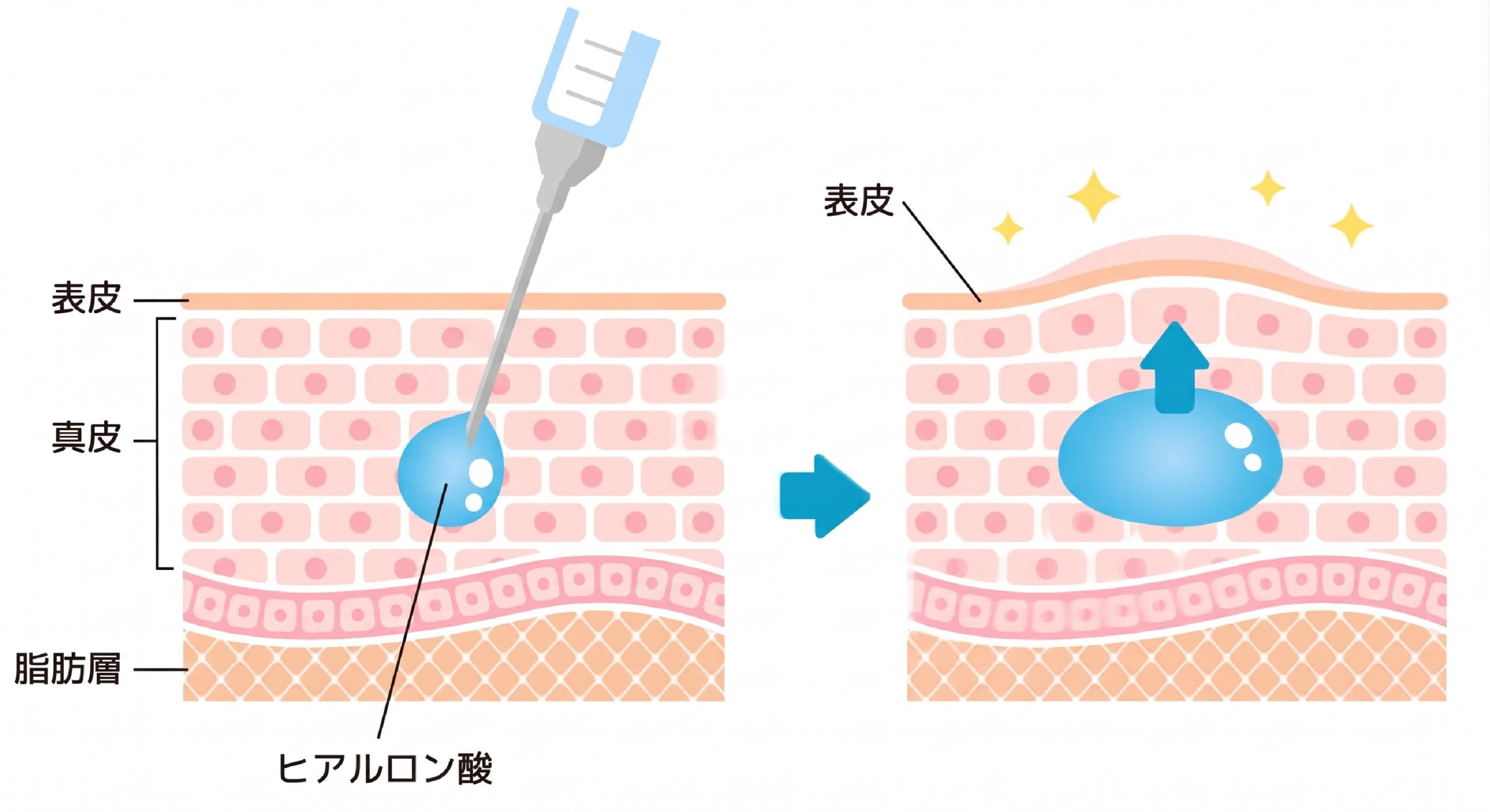 入れたその日から変化が分かります