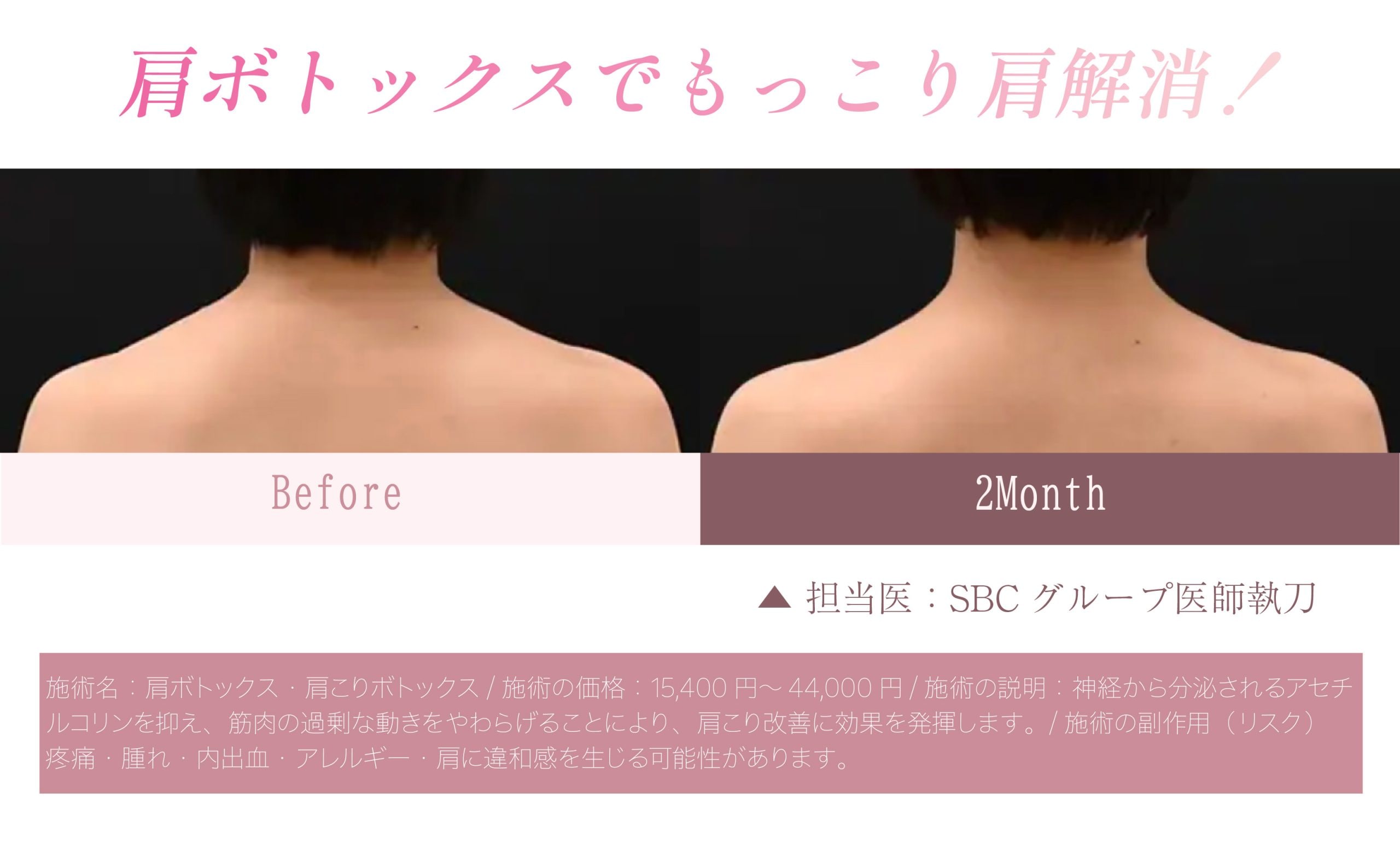 肩の盛り上がりが落ちると、鎖骨が見えてきます