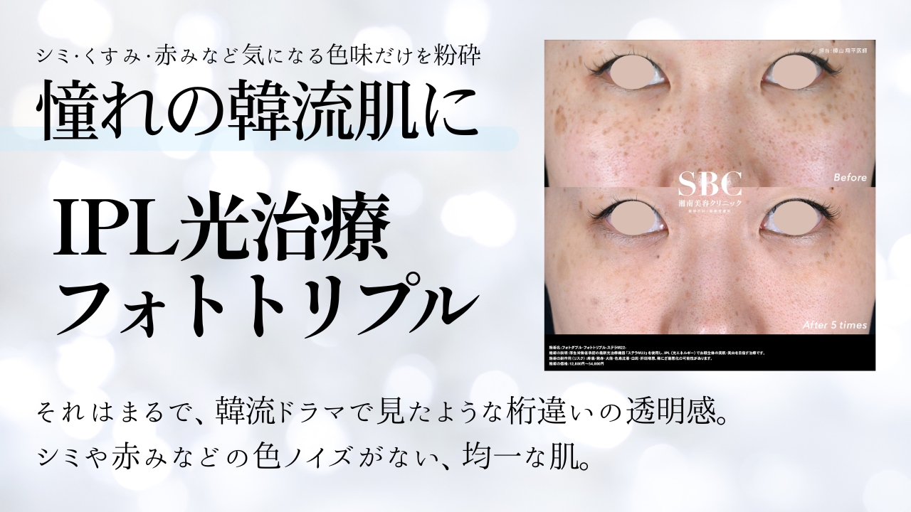 シミもくすみも同時にケアできる「フォトトリプル」は横浜青葉台院で