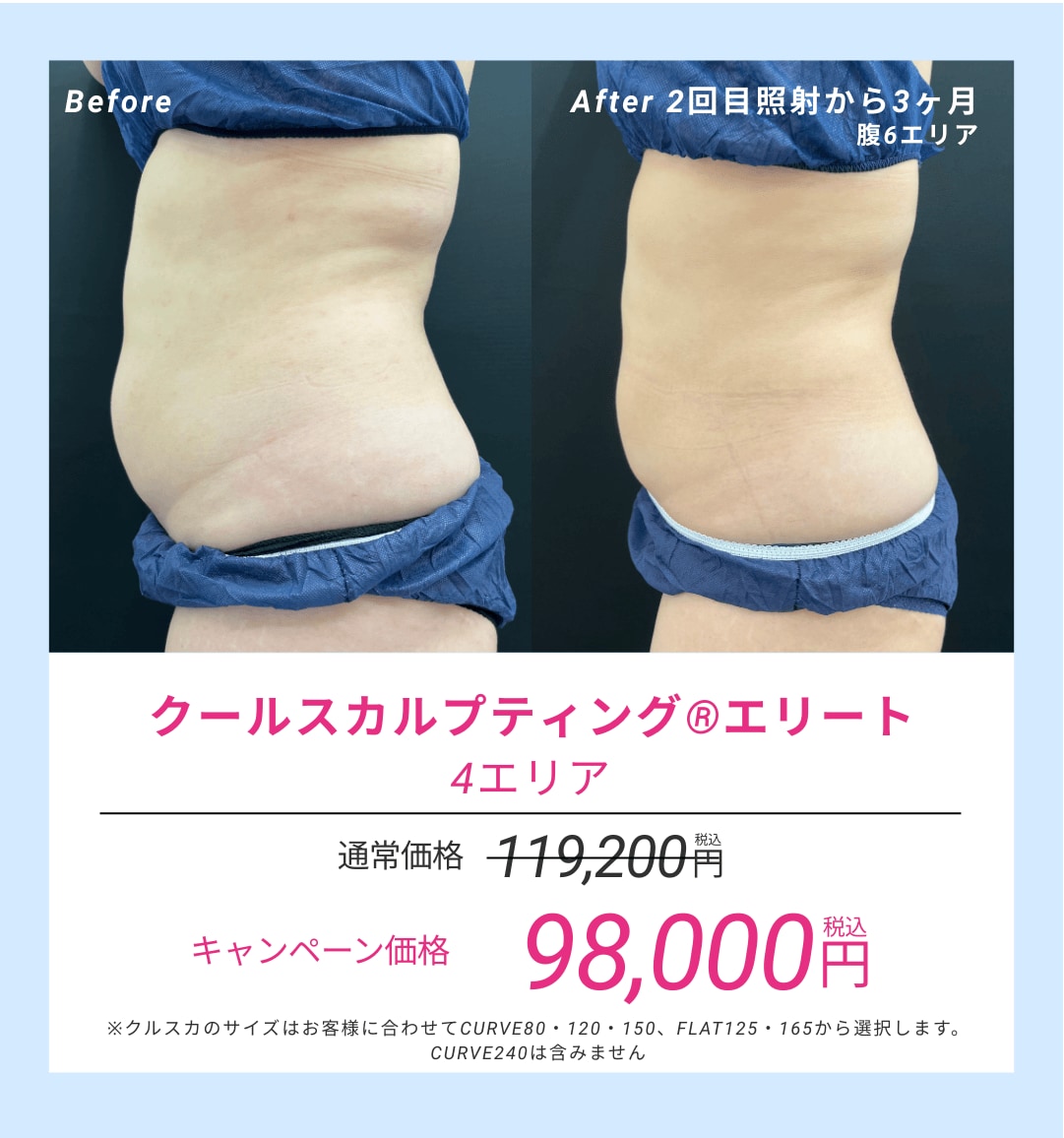 約2万円割引中🔥