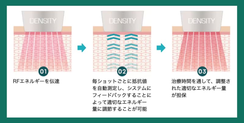 均一なエネルギー照射でムラのない仕上がり