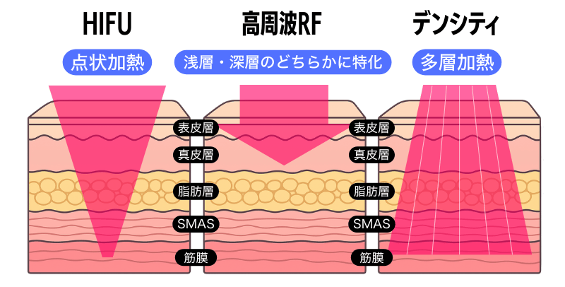 他治療との違い