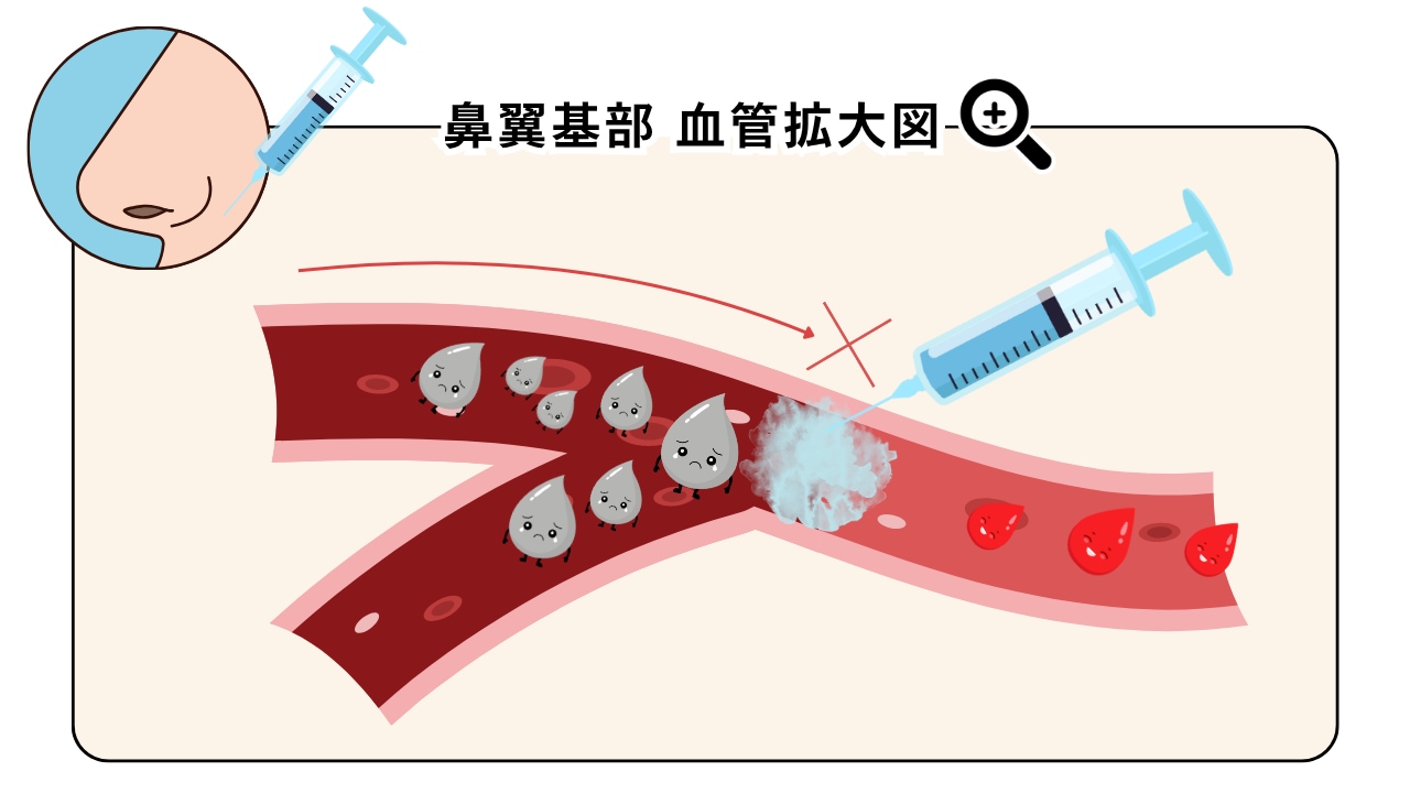 リスクが高いとされる理由と安全対策