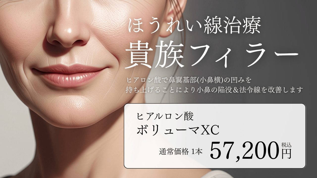 鼻翼基部ヒアルロン酸注入