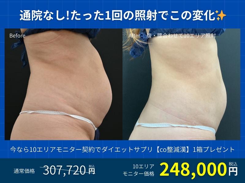 1回でどれくらい効果が出るの？