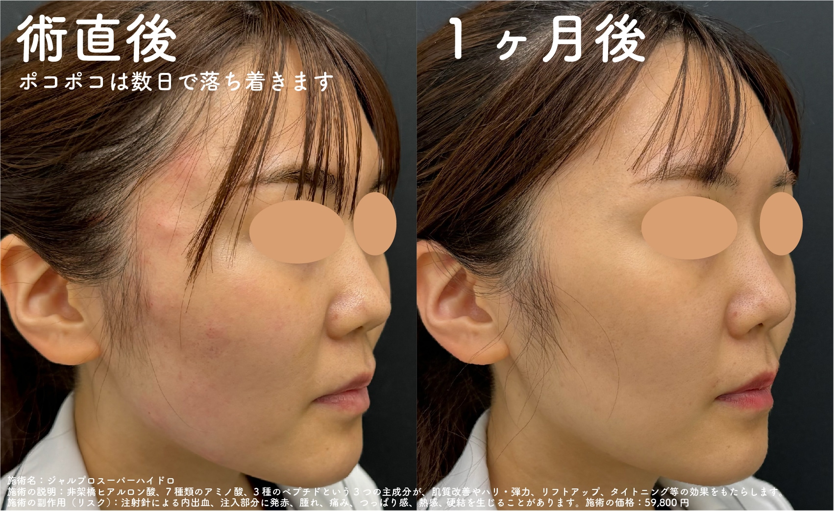 実際に受けてみた