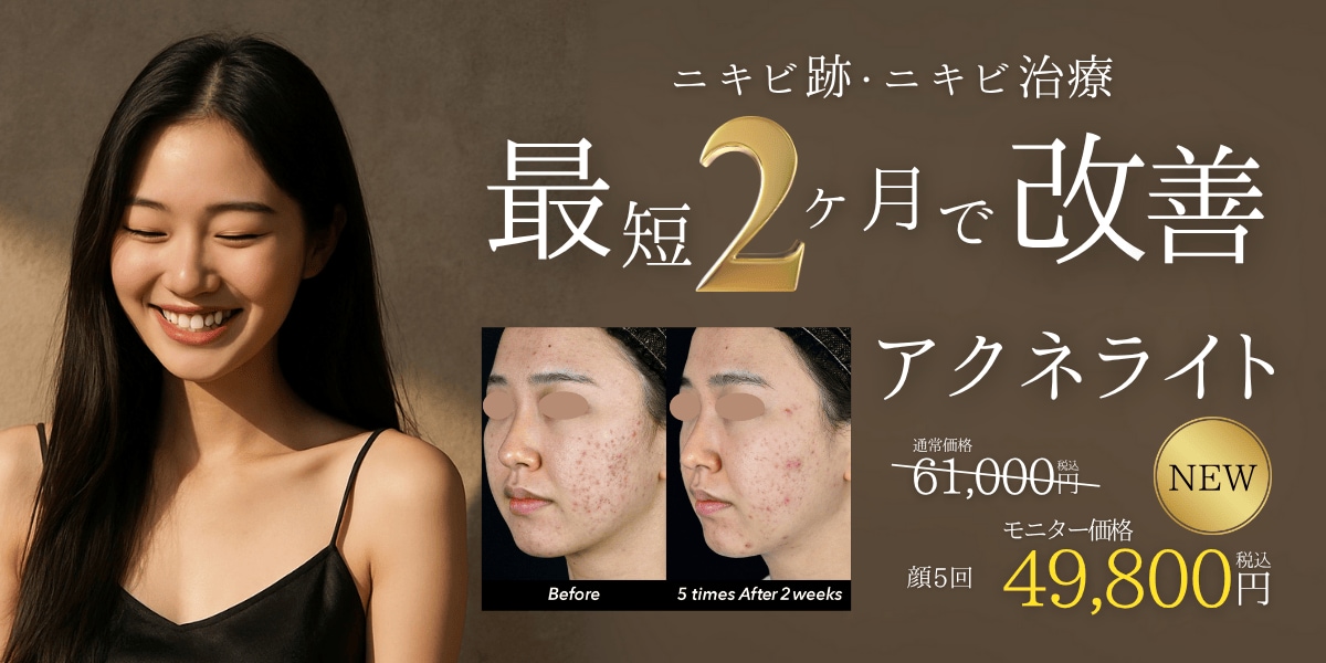 ニキビに悩んでる人必見👀‼️