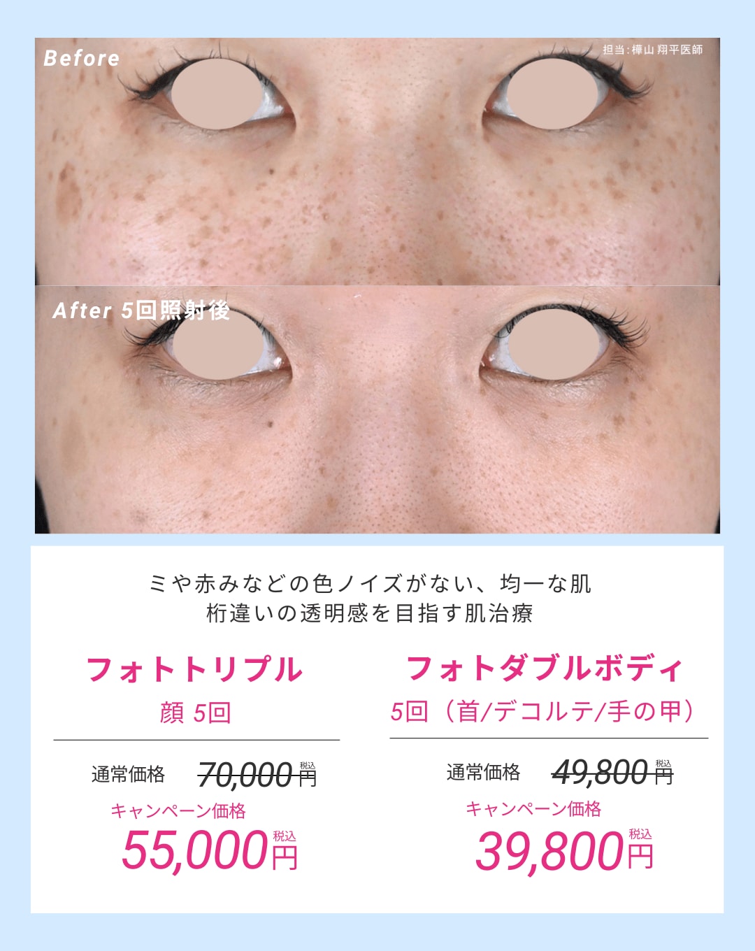 5回コースで徹底肌活✨