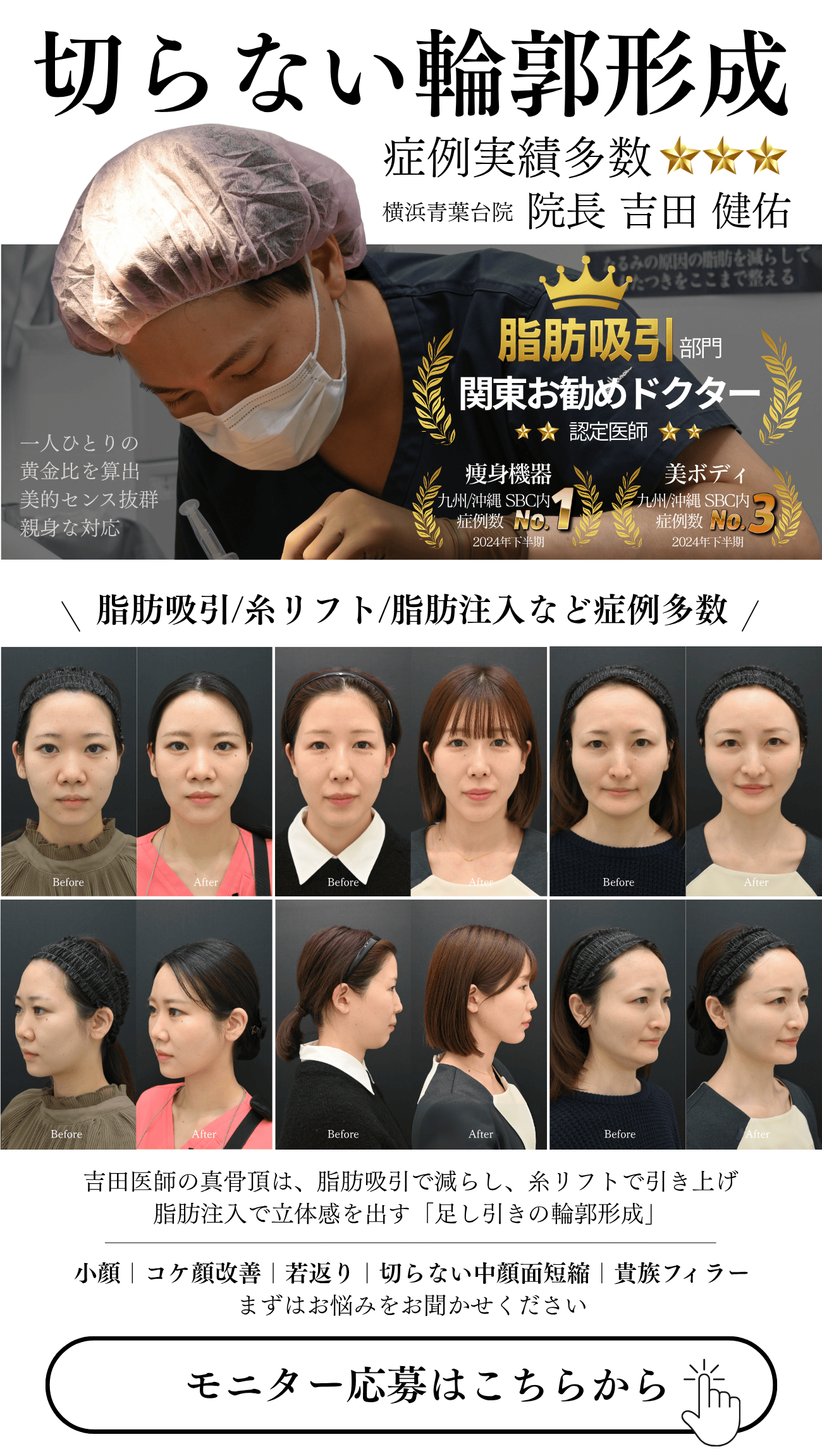 Dr.吉田の輪郭形成モニター