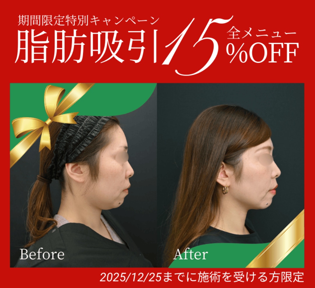 冬のイベントで魅せる！【顔・二の腕スッキリ】キャンペーン