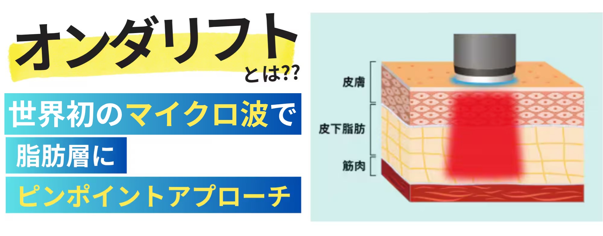 究極のハイブリッド治療！