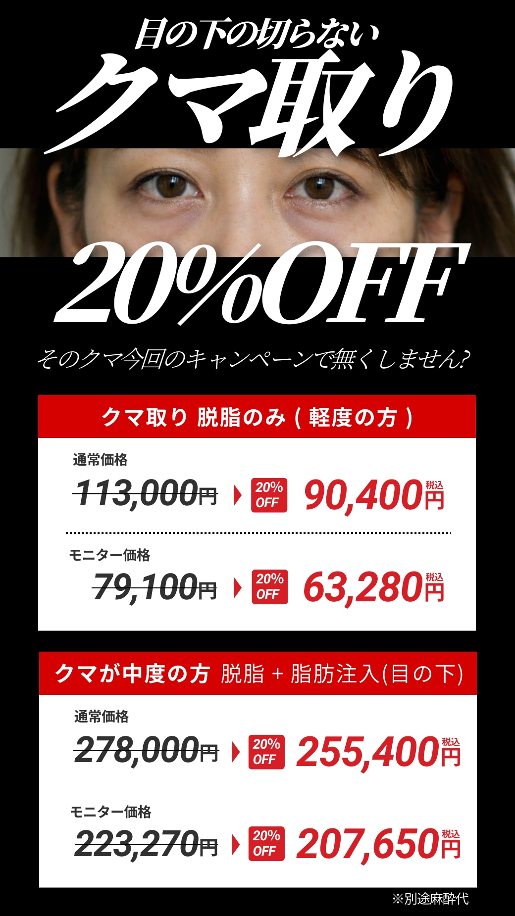 クマ取りキャンペーン✨