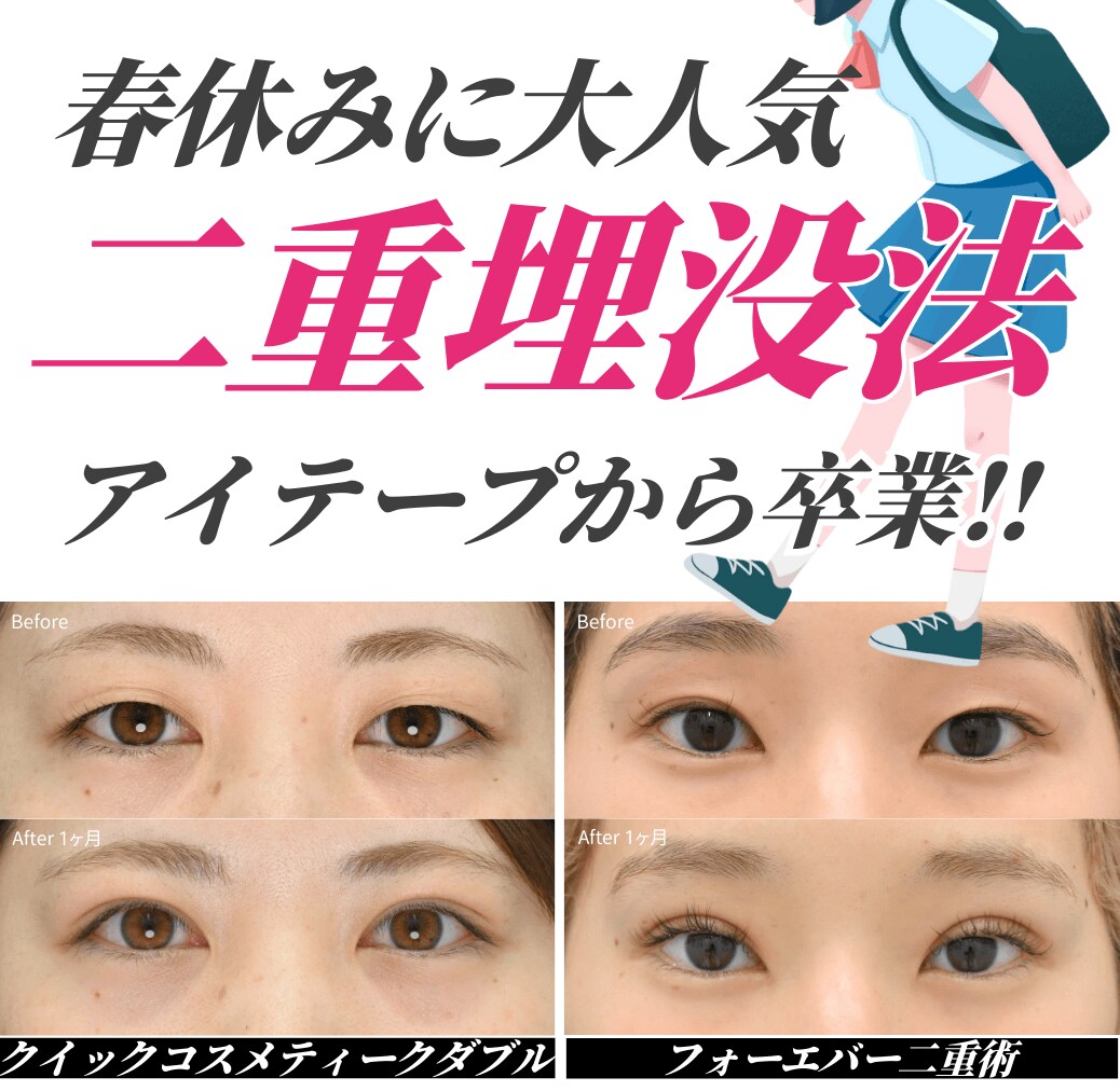 週末二重👀3/31まで❗️