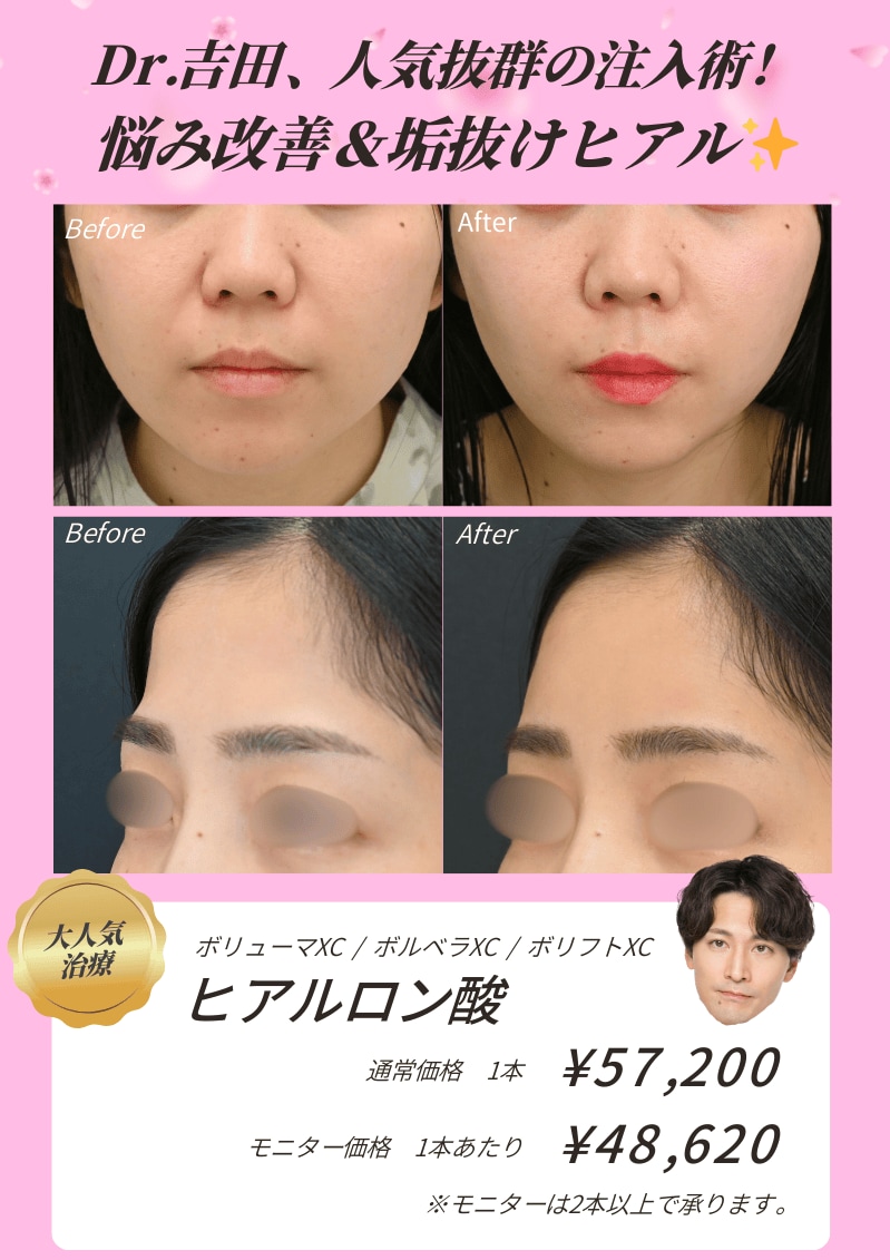 気になる部分だけアプデ🎵