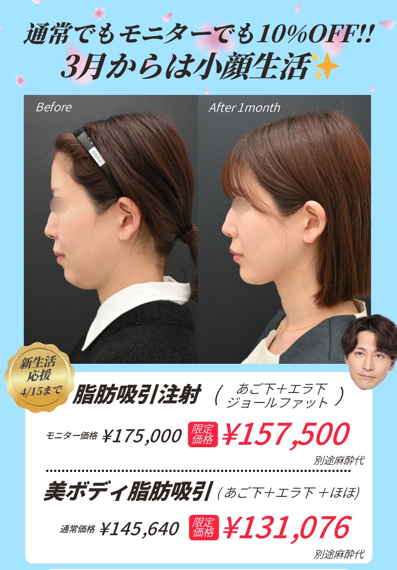 脂肪吸引が10％OFF🩵