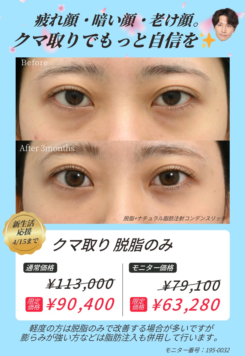 クマ取り20%OFF🚨4月15日(水)まで❗️