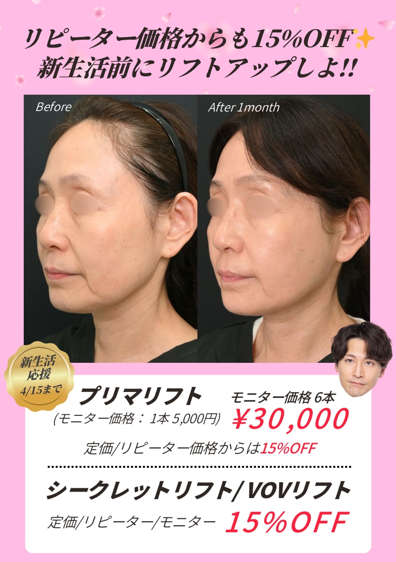 糸リフトが15%OFF💖