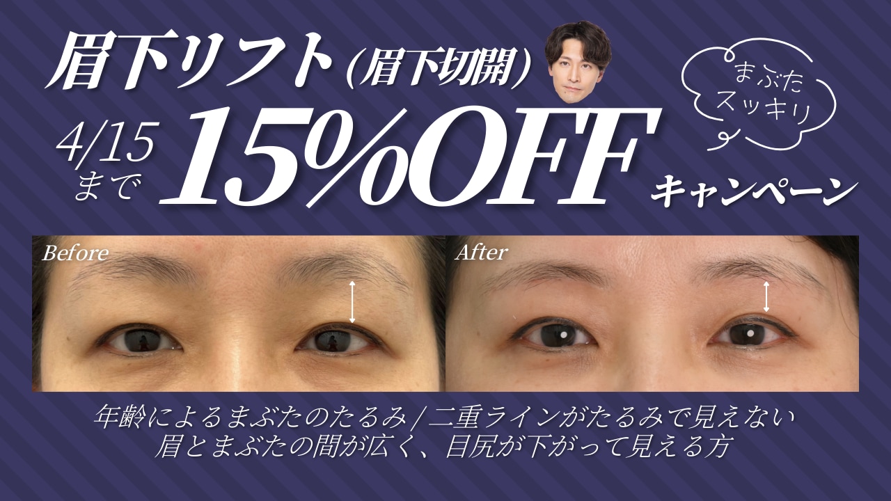 実は眉下リフトもキャンペーン中🩷