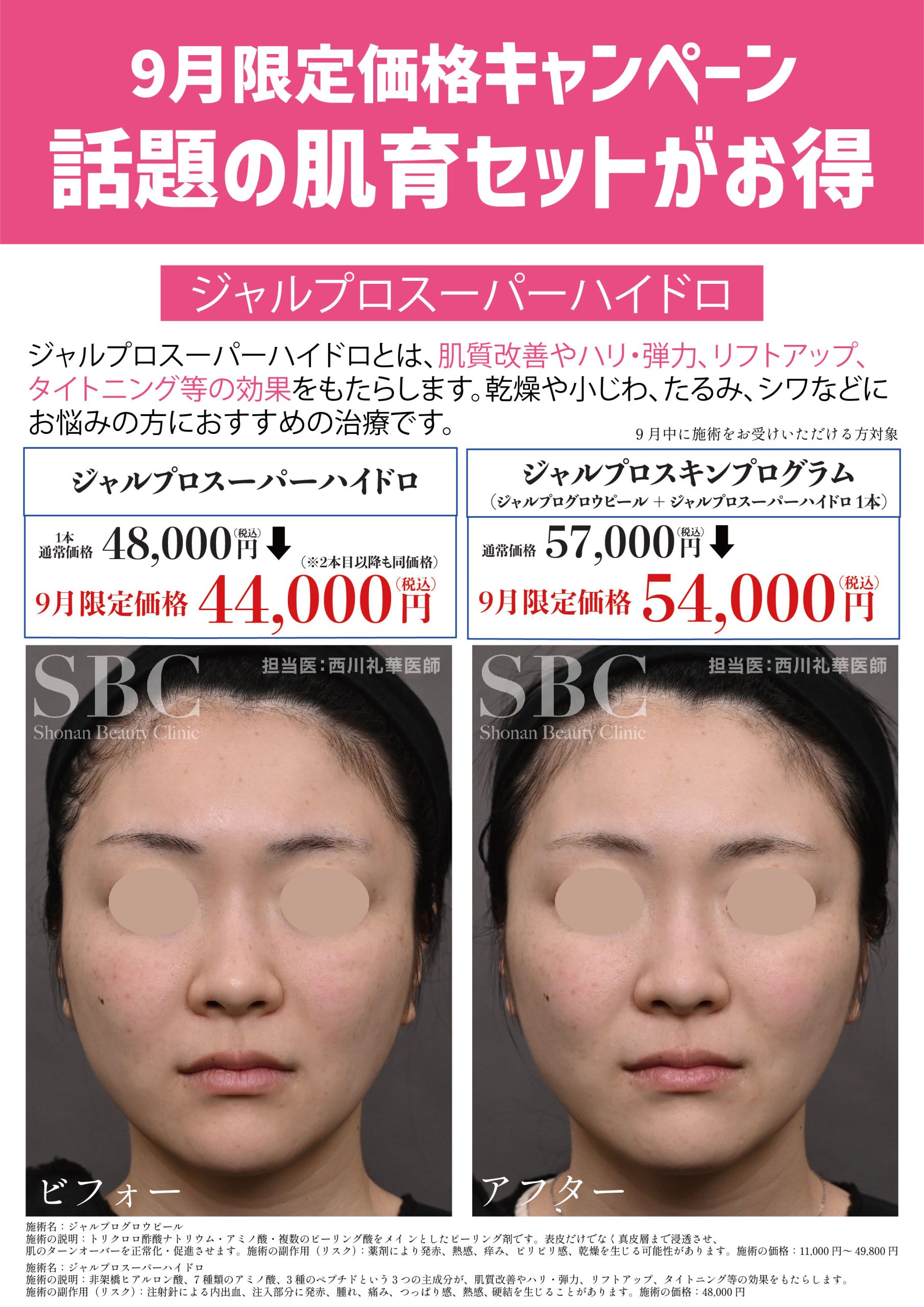 ジャルプロスーパーハイドロ/ジャルプロスキンプログラム