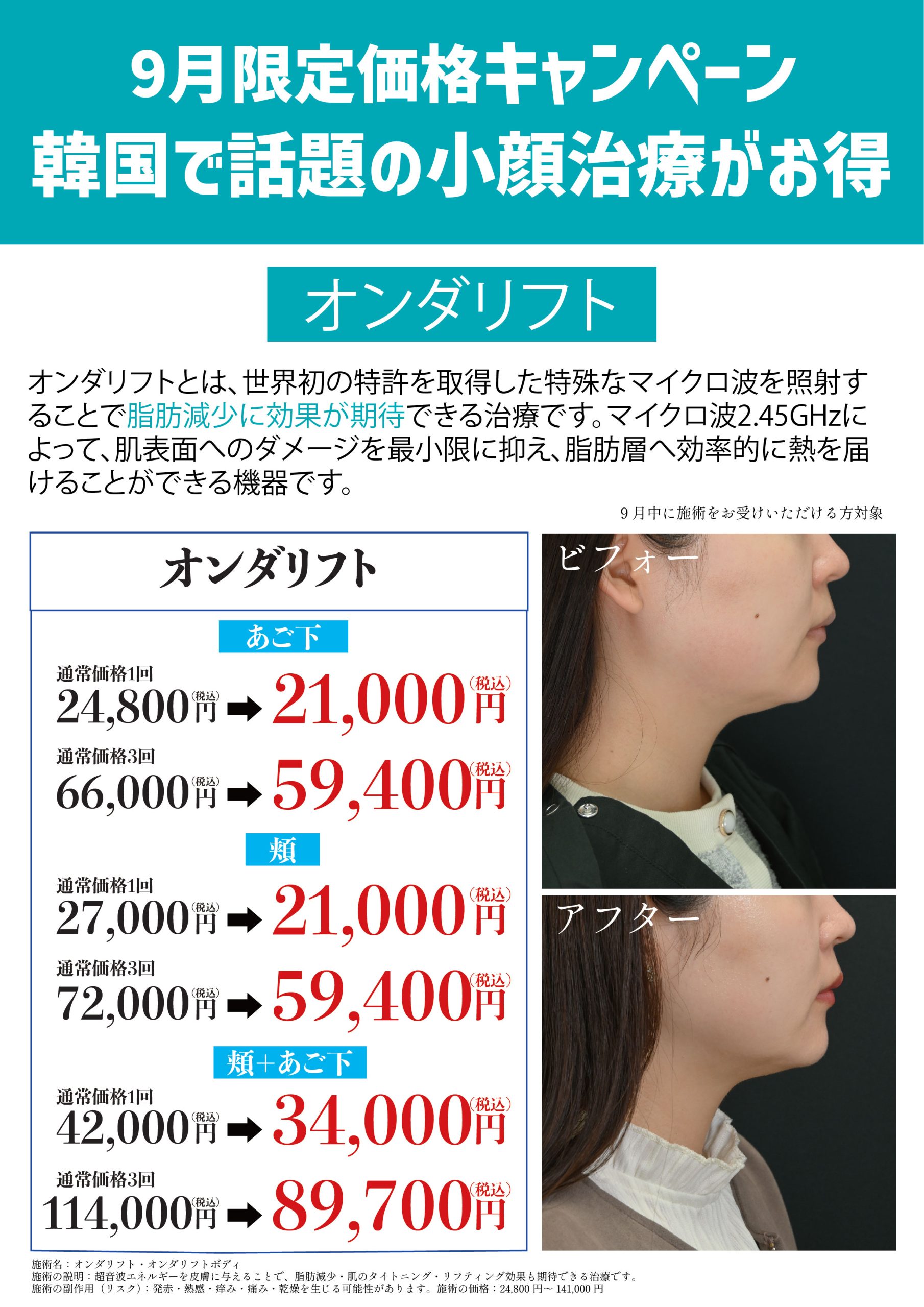 オンダリフト