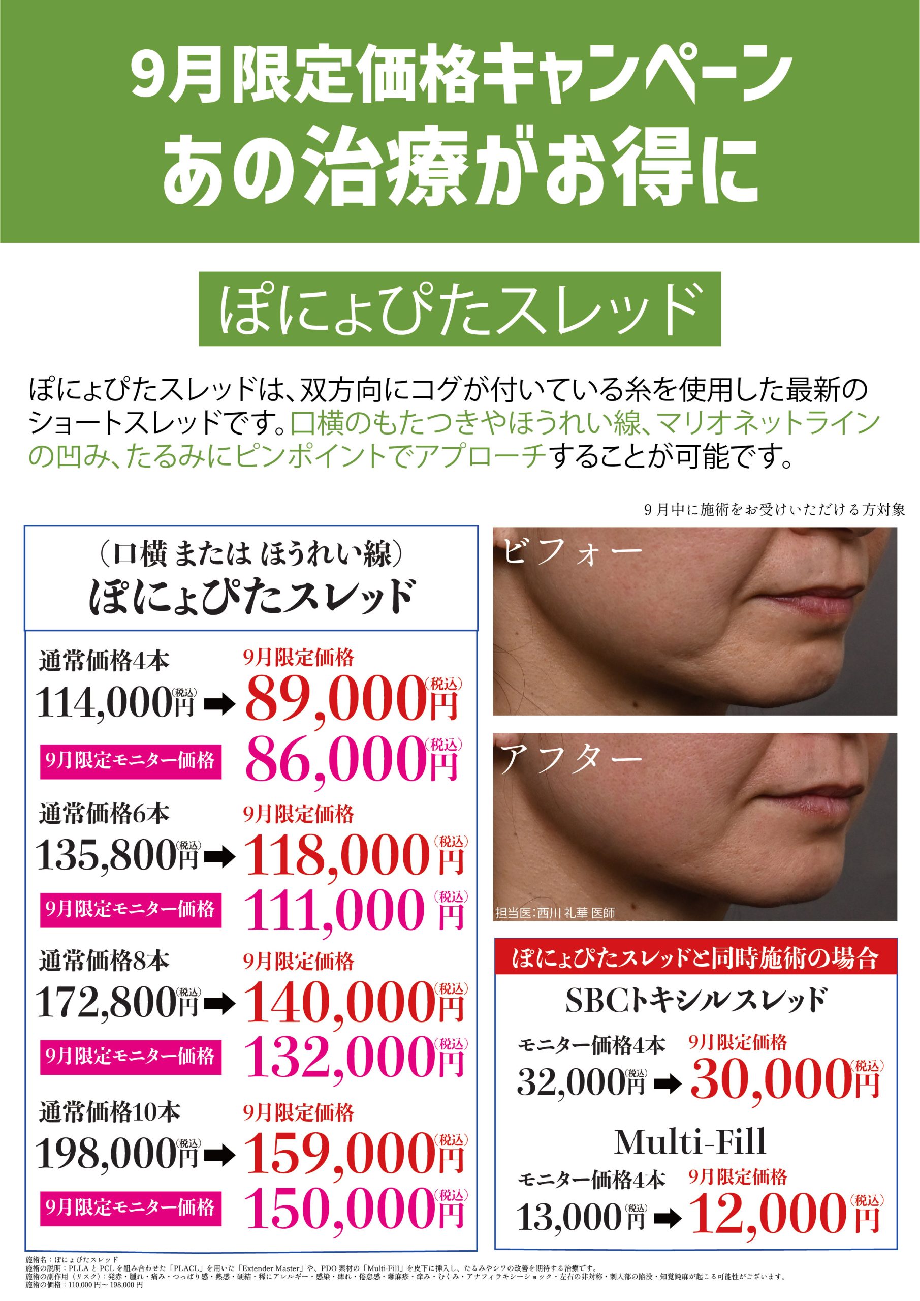 ぽにょぴたスレッド