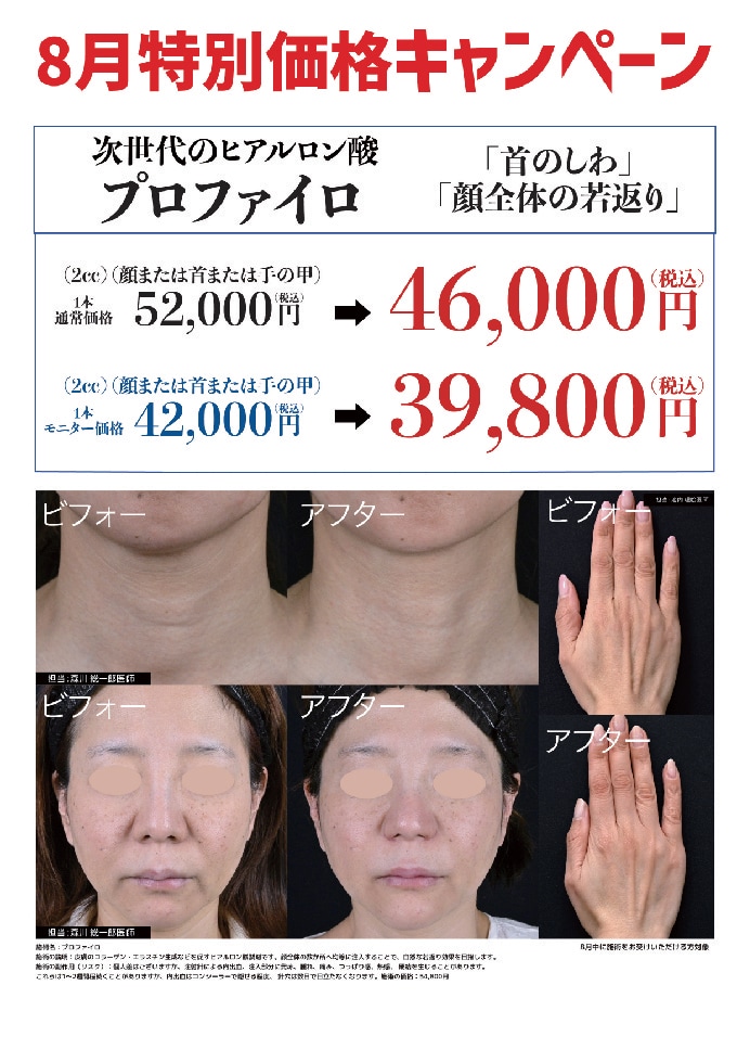プロファイロ