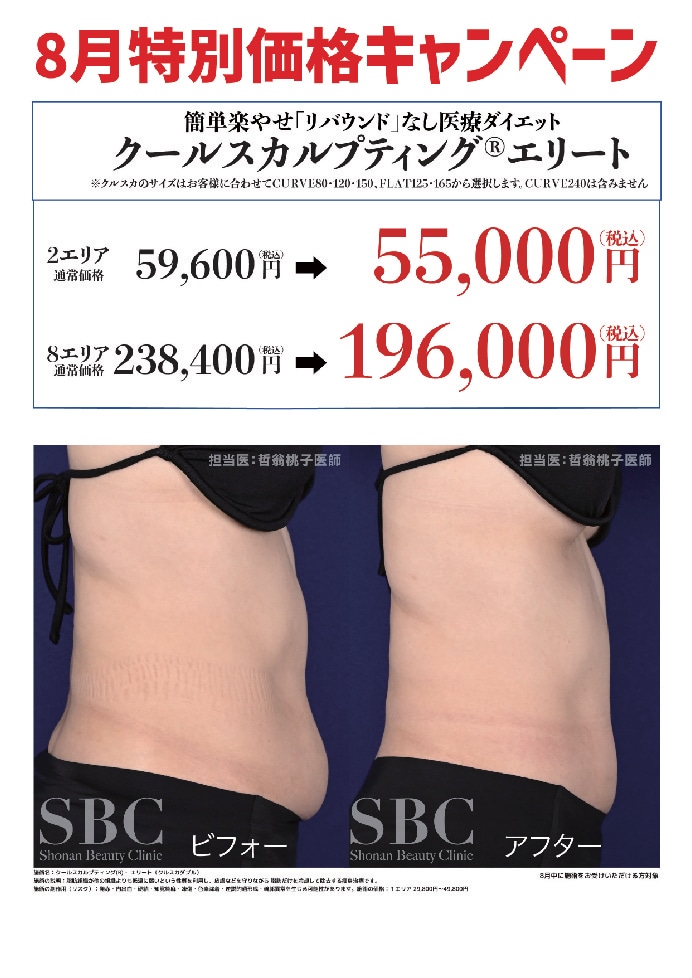 クールスカルプティング®エリート