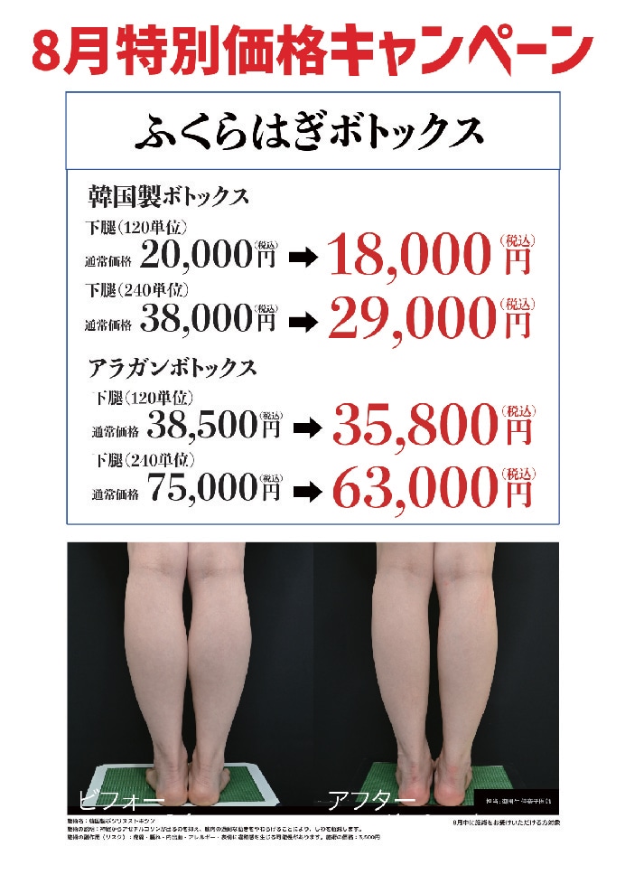 ふくらはぎボトックス