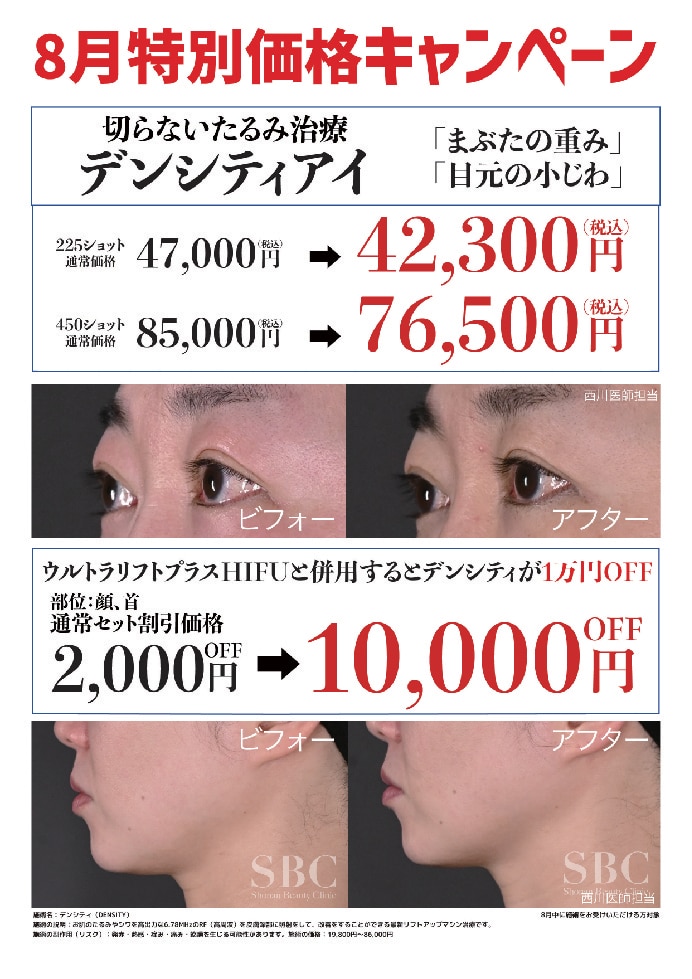 ①DENSITYアイ（デンシティアイ）<br />
②｢HIFU｣と｢高周波治療｣を同日施術で1万円割引