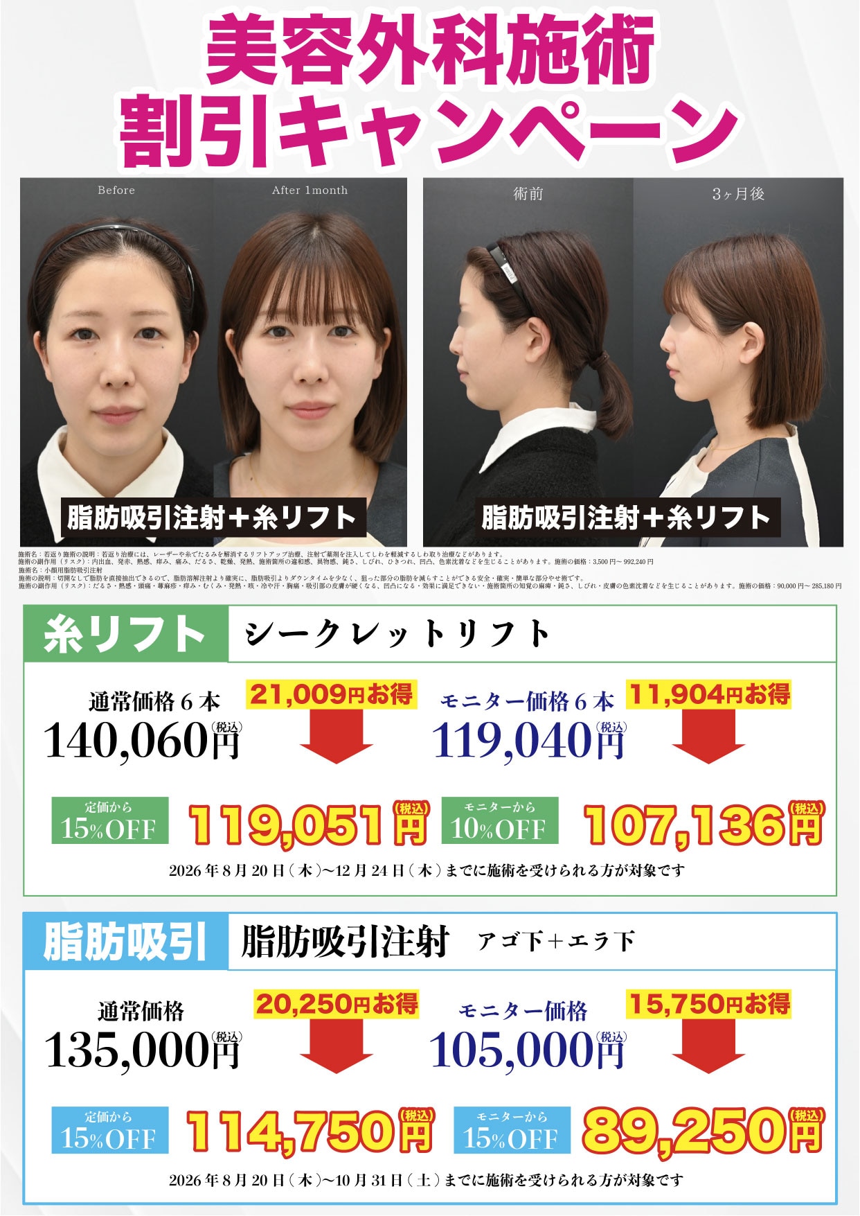 脂肪吸引注射