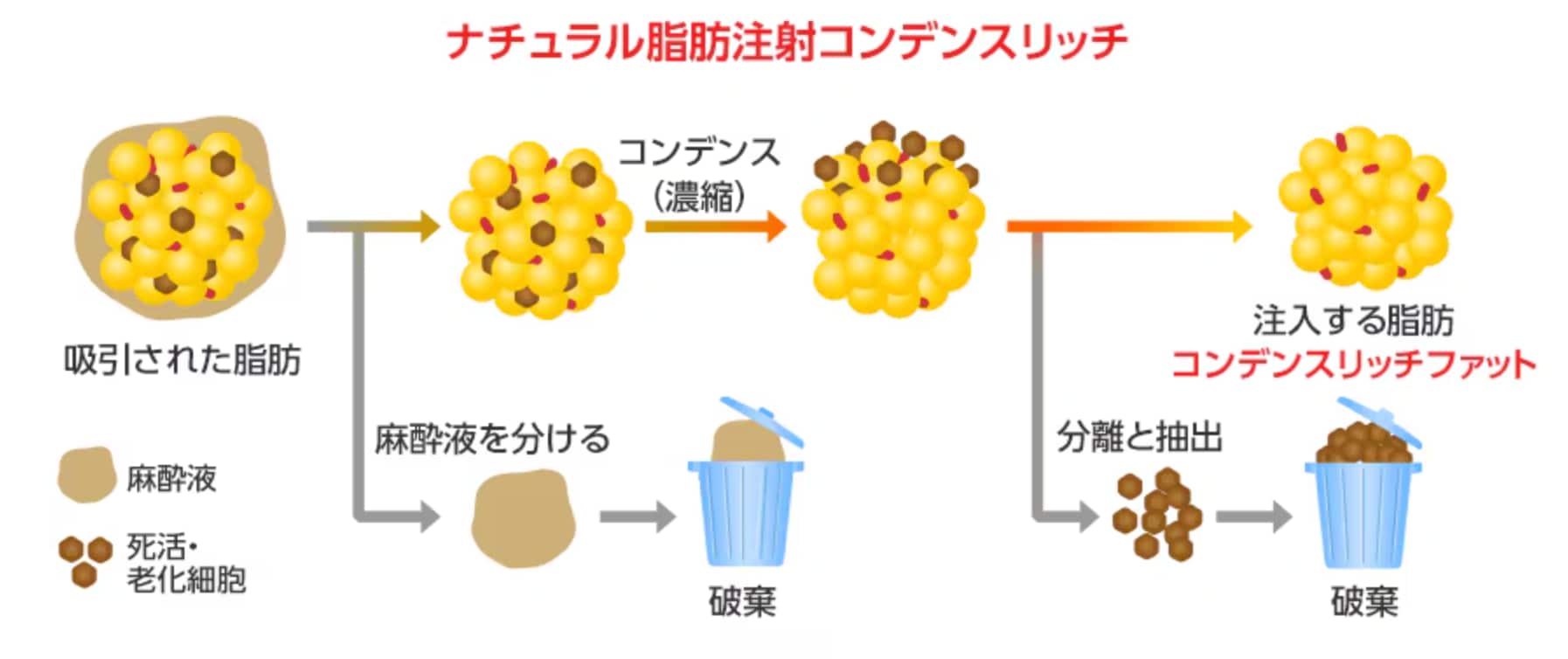 自身の脂肪を注入