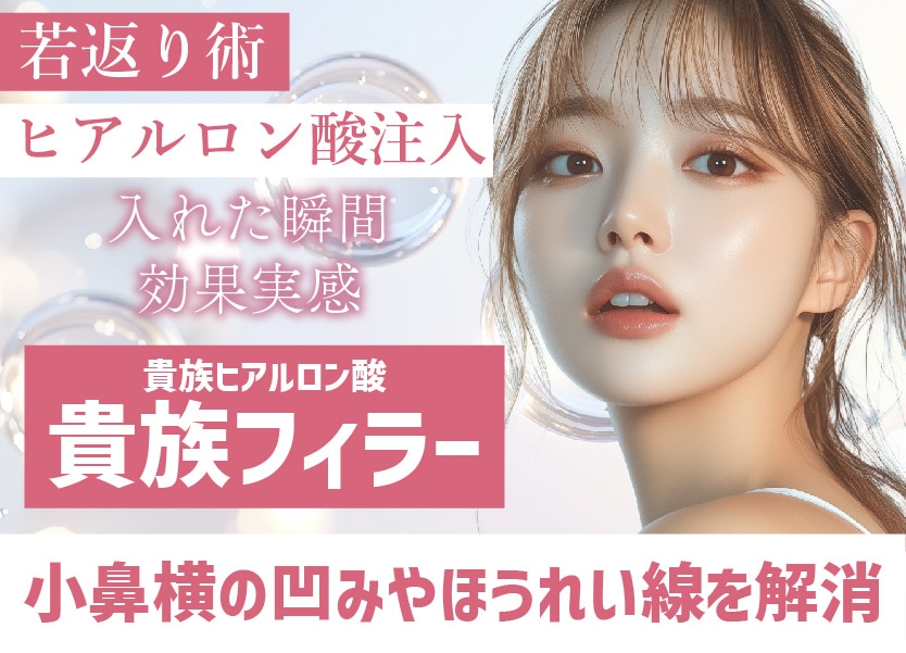 【貴族フィラーのプロ】ヒアルロン酸で輪郭形成！