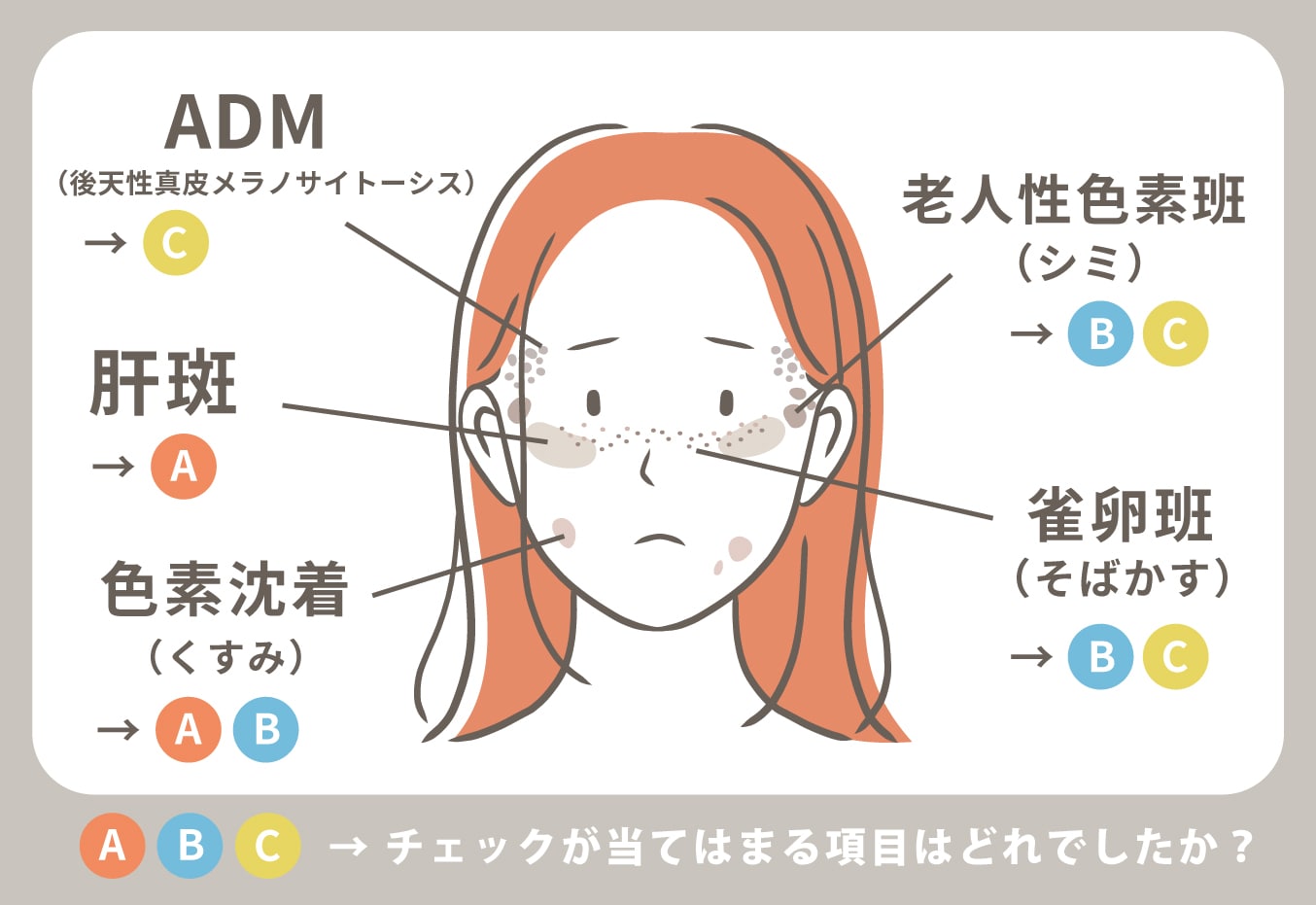 まずは自分のシミタイプをチェック!