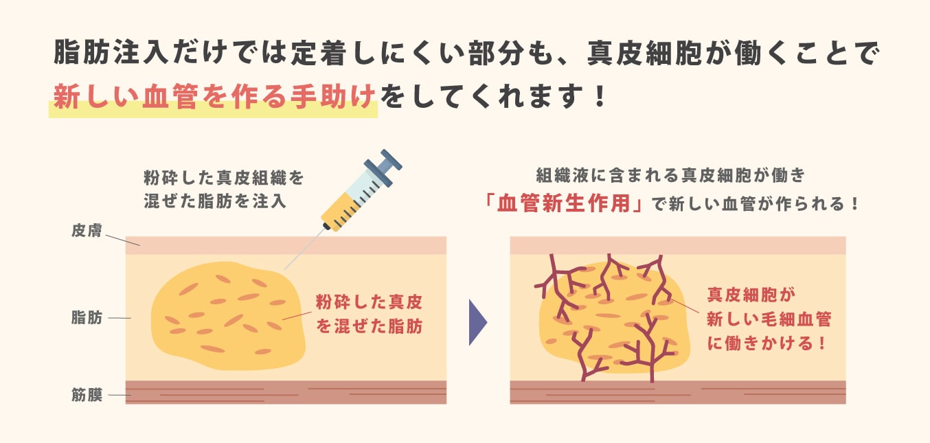 「血管新生作用」で定着率UP!