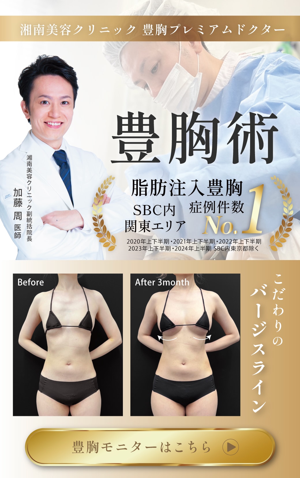豊胸 脂肪注入豊胸 極上のバージスライン 下乳 加藤周医師