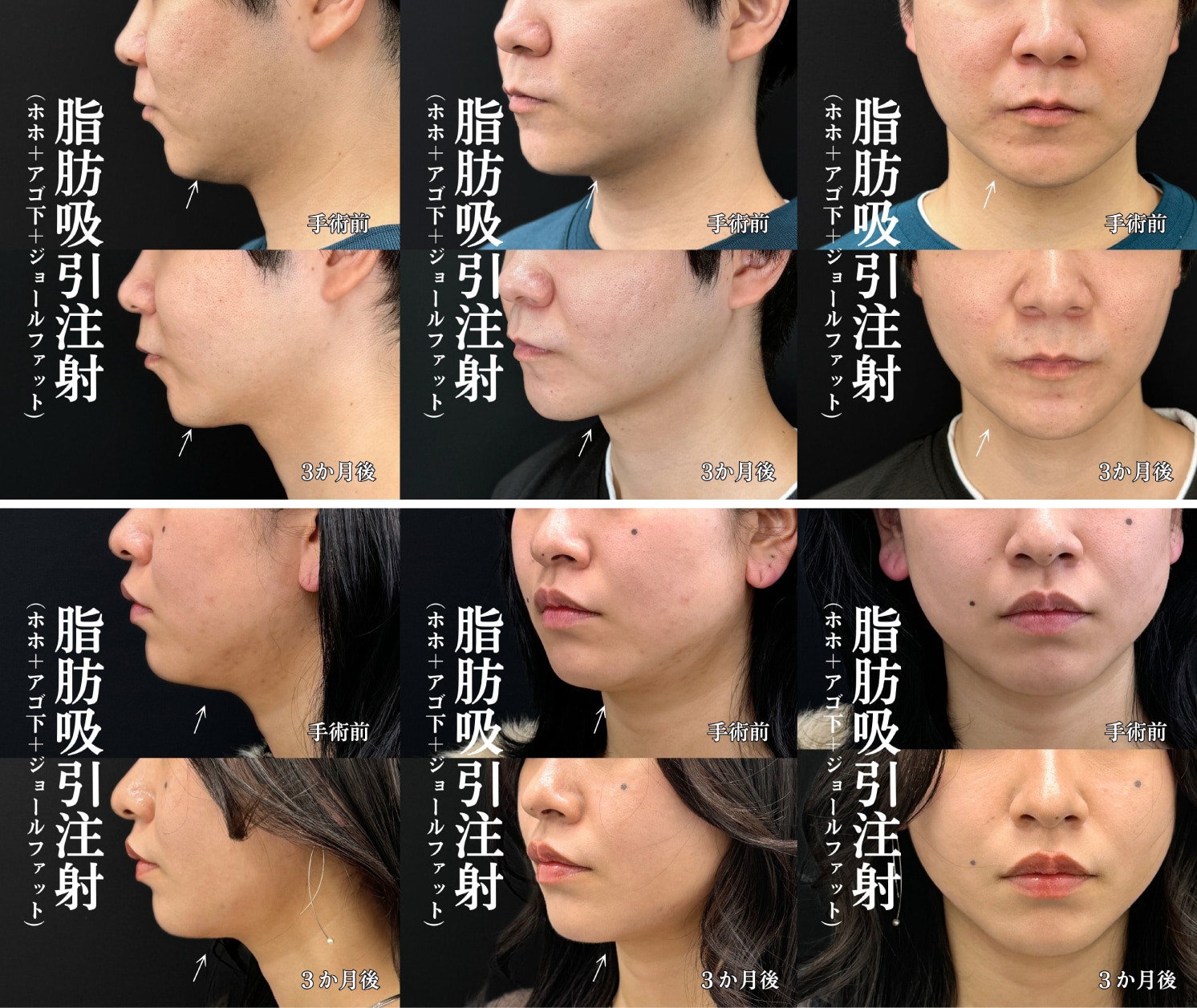 細部まで計算され尽くした、バランスの良い仕上がり