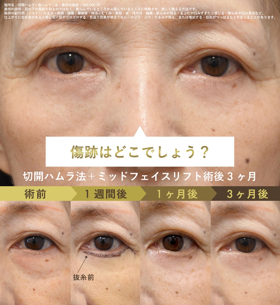 傷跡に対する不安を技術力で解消します