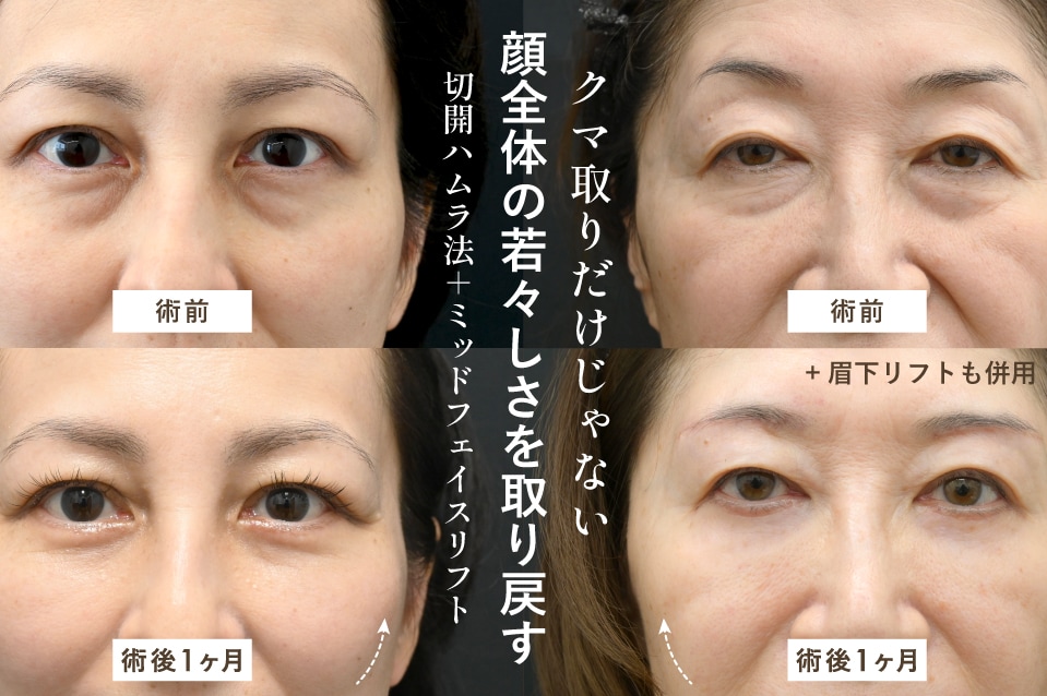 顔全体の黄金比を考慮したデザインをご提案