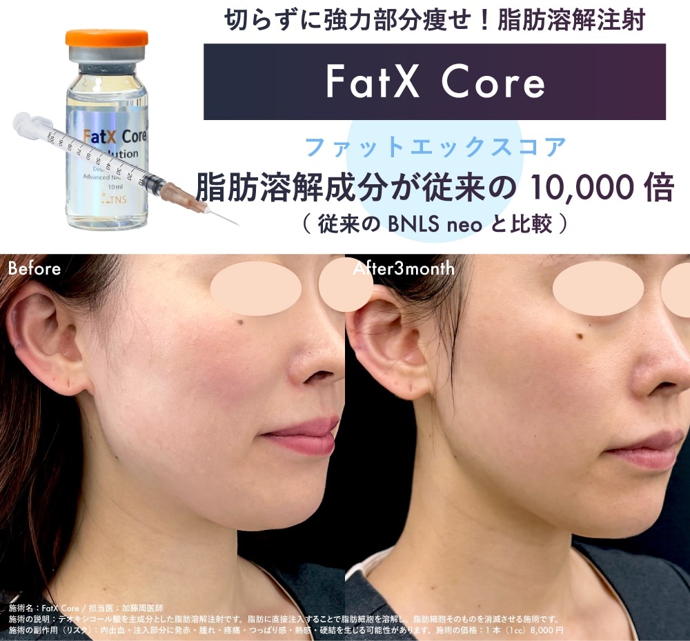 【FatX Core】（ファットエックスコア）