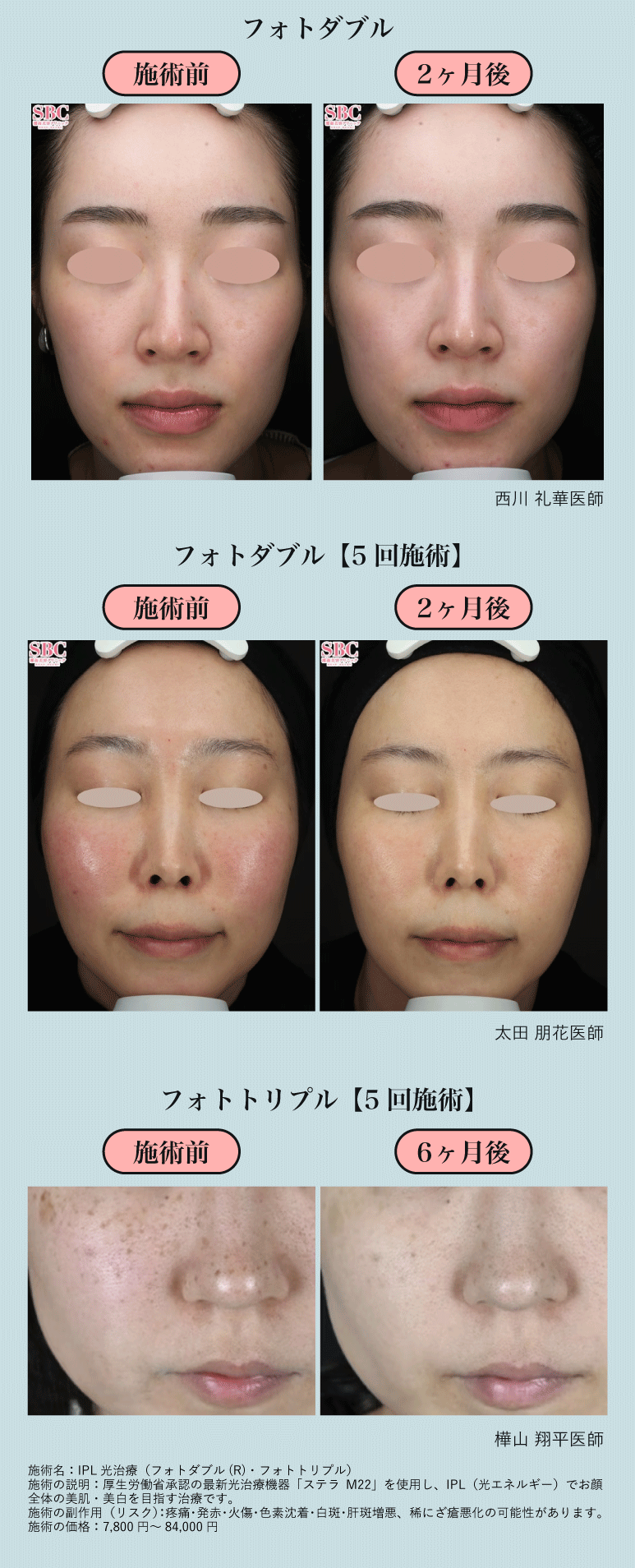 回数を重ねることで桁違いに肌が変わります
