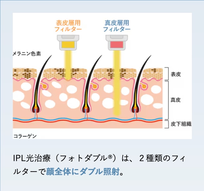複数の特殊な波長の光を肌に照射し、真皮の細胞へアプローチ